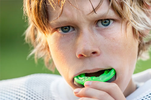 Play to Win With a Custom Sports Mouthguard